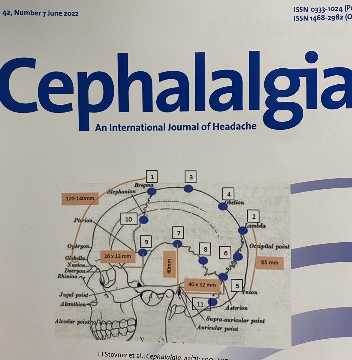 International Forum for Headache Nurses (IFHN) (@headachenurses) on Twitter photo Well done to our member of the board <a href="/gorilbg/">Gøril B Gravdahl</a> , one of the co-authors of FollowTheSutures: a pilot study on a possible new ways of administering onabotulinumtoxinA for chronic migraine. journals.sagepub.com/doi/10.1177/03… Well done to our member of the board <a href="/gorilbg/">Gøril B Gravdahl</a> , one of the co-authors of FollowTheSutures: a pilot study on a possible new ways of administering onabotulinumtoxinA for chronic migraine. journals.sagepub.com/doi/10.1177/03…