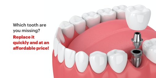 DINP_UK's tweet photo. Which tooth are you missing? Replace your lost tooth for a price that only our clinic can guarantee!
. 
.
.
.
.
#dinpuk #dentalimplants #oralhealth #dentist #FixedProsthesis https://t.co/TDjHHDiqly