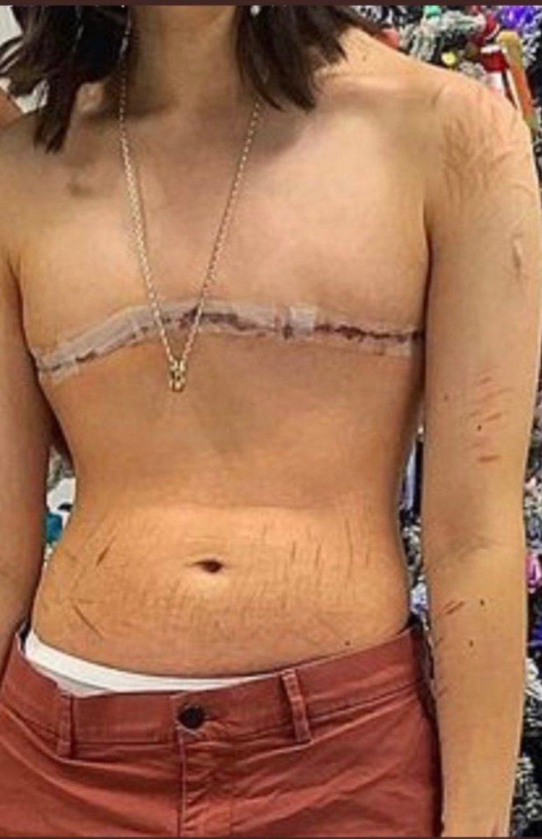 ¿En qué punto adultos funcionales os habéis convertido en fanáticos de secta incapaces de analizar las consecuencias de castrar, mutilar, dejar anorgásmicas, provocar la menopausia y convertir menores sanas en pacientes/consumidoras/clientes de por vida por sexismo rancio?