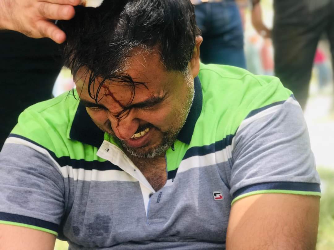 الاعتداء بالضرب على حملة الشهادات العليا في العراق 
الثلاثاء ٢٨.٦.٢٠٢٢
#الشهادات_العليا_تقمع