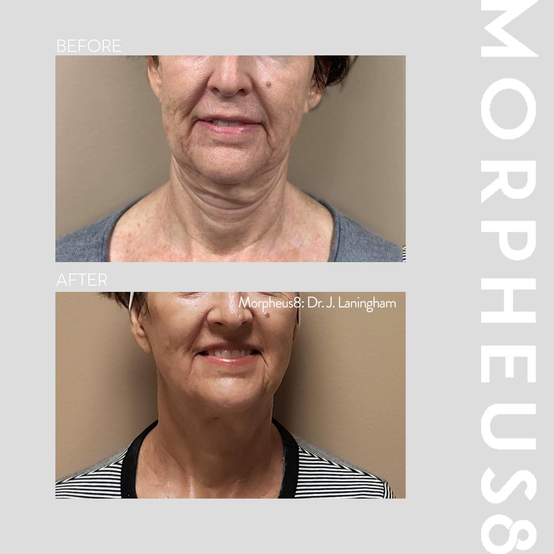 @dermaspa_mk tweet media