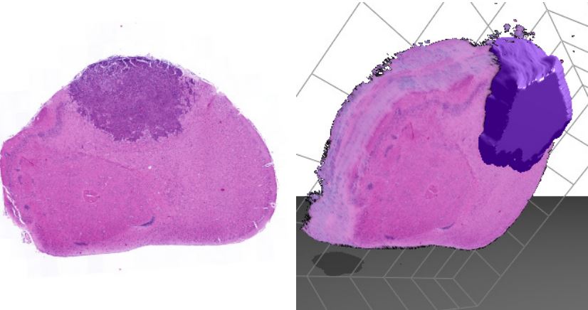 We are excited to announce that Microvisioneer has just become the worldwide exclusive distributor of microDimensions Voloom, a proven, robust and easy digital pathology software solution for #3Dhistology reconstruction and analyses.
micro-dimensions.com/voloom