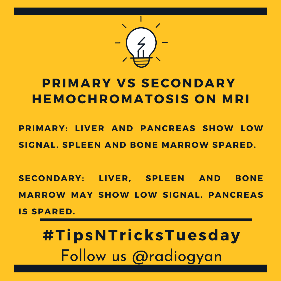 TeamRadioGyan's tweet image. #TipsnTricksTuesday 

Here is a pearl about primary vs secondary hemochromatosis. 
 
All credits to #TeamGyan member Dr. Dev.
Follow him on Instagram @drdevrad for more.

#primary 
#radiogyan #studygram #study #learning #radiology #radiologist #radiologie #radiologi #radiologia