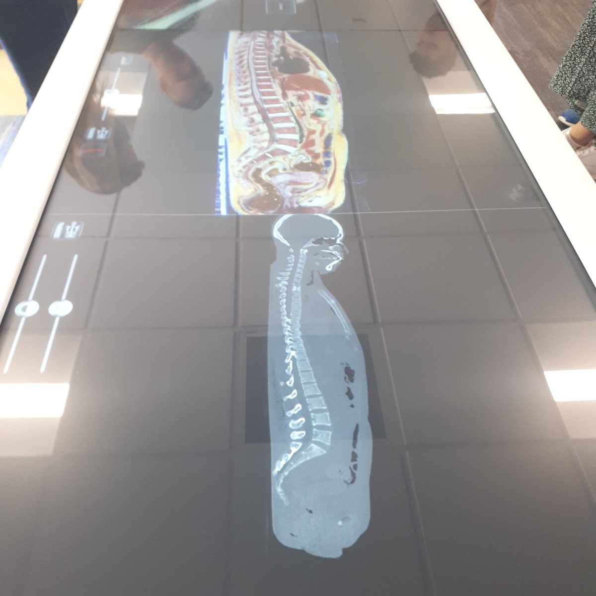 UoB Diagnostic Radiography (@brightrads) on Twitter photo Checking out the Anatomage table today <a href="/uniofbrighton/">University of Brighton</a> Eastbourne Campus. Great demonstration of a CT scan and the corresponding anatomy.  Brilliant visual learning for our future students! Thank you <a href="/Anatomage/">Anatomage</a> Checking out the Anatomage table today <a href="/uniofbrighton/">University of Brighton</a> Eastbourne Campus. Great demonstration of a CT scan and the corresponding anatomy.  Brilliant visual learning for our future students! Thank you <a href="/Anatomage/">Anatomage</a>