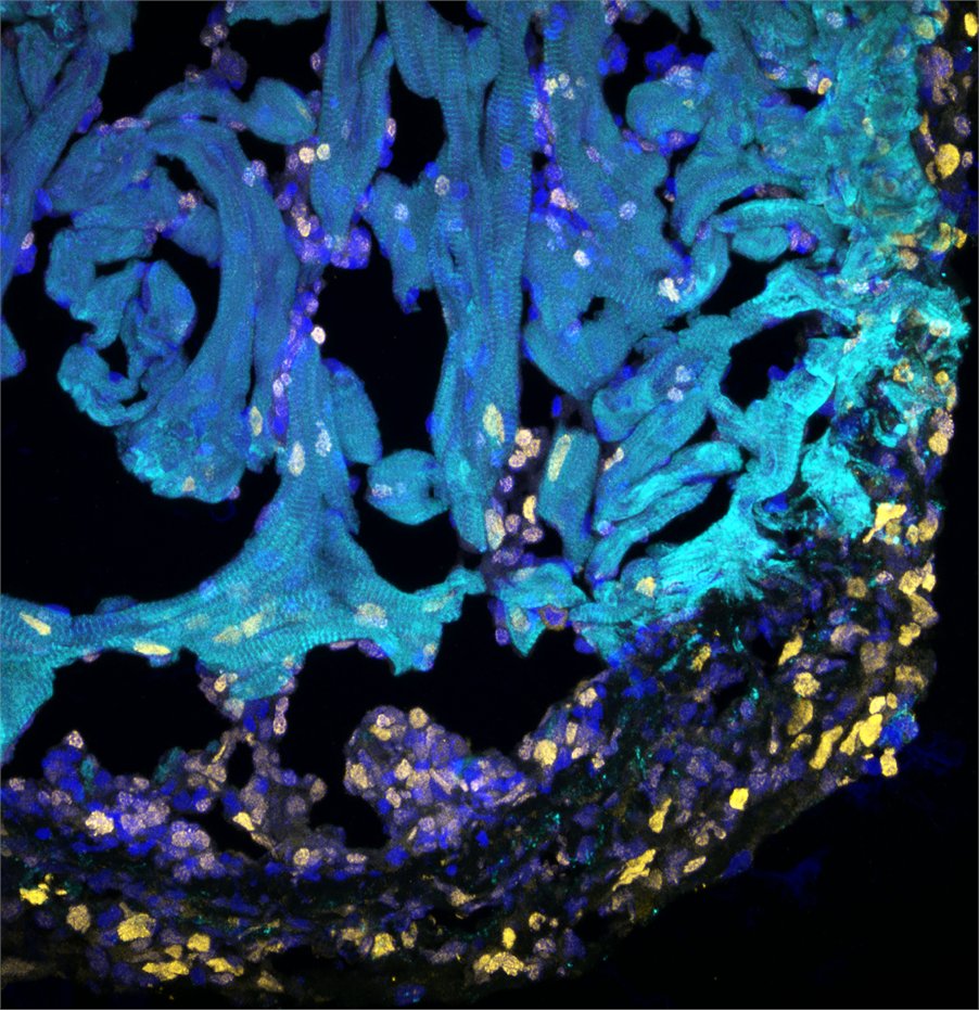 Filipa Simões (@simoesfili) on Twitter photo We are hiring! Join our team <a href="/IdrmOxford/">Oxford_IDRM</a> <a href="/OxfordMedSci/">Medical Sciences</a> if #macrophages, #cardiac #regeneration, #Omics, #zebrafish & curiosity-led colleagues are your gig! Come and join us, it will be fun! DM any questions 🙏RT #ScienceJobs <a href="/UniofOxford/">University of Oxford</a>
my.corehr.com/pls/uoxrecruit… We are hiring! Join our team <a href="/IdrmOxford/">Oxford_IDRM</a> <a href="/OxfordMedSci/">Medical Sciences</a> if #macrophages, #cardiac #regeneration, #Omics, #zebrafish & curiosity-led colleagues are your gig! Come and join us, it will be fun! DM any questions 🙏RT #ScienceJobs <a href="/UniofOxford/">University of Oxford</a>
my.corehr.com/pls/uoxrecruit…