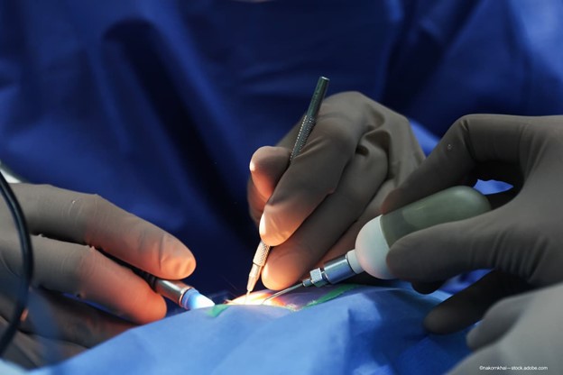 MST_eye's tweet photo. Prof. Boris Malyugin explains how the Malyugin Ring 2.0 simplifies challenging cases of small pupils with zonulopathy by both stabilizing the capsular bag and dialating the pupil. Read more here:
https://t.co/IUNa9F2L2R
#ComplexCasesSimplified #MalyuginRing https://t.co/N2voWdKb7t