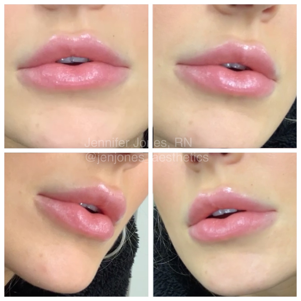 Nayak Plastic Surgery & Avani Derm Spa tweet media