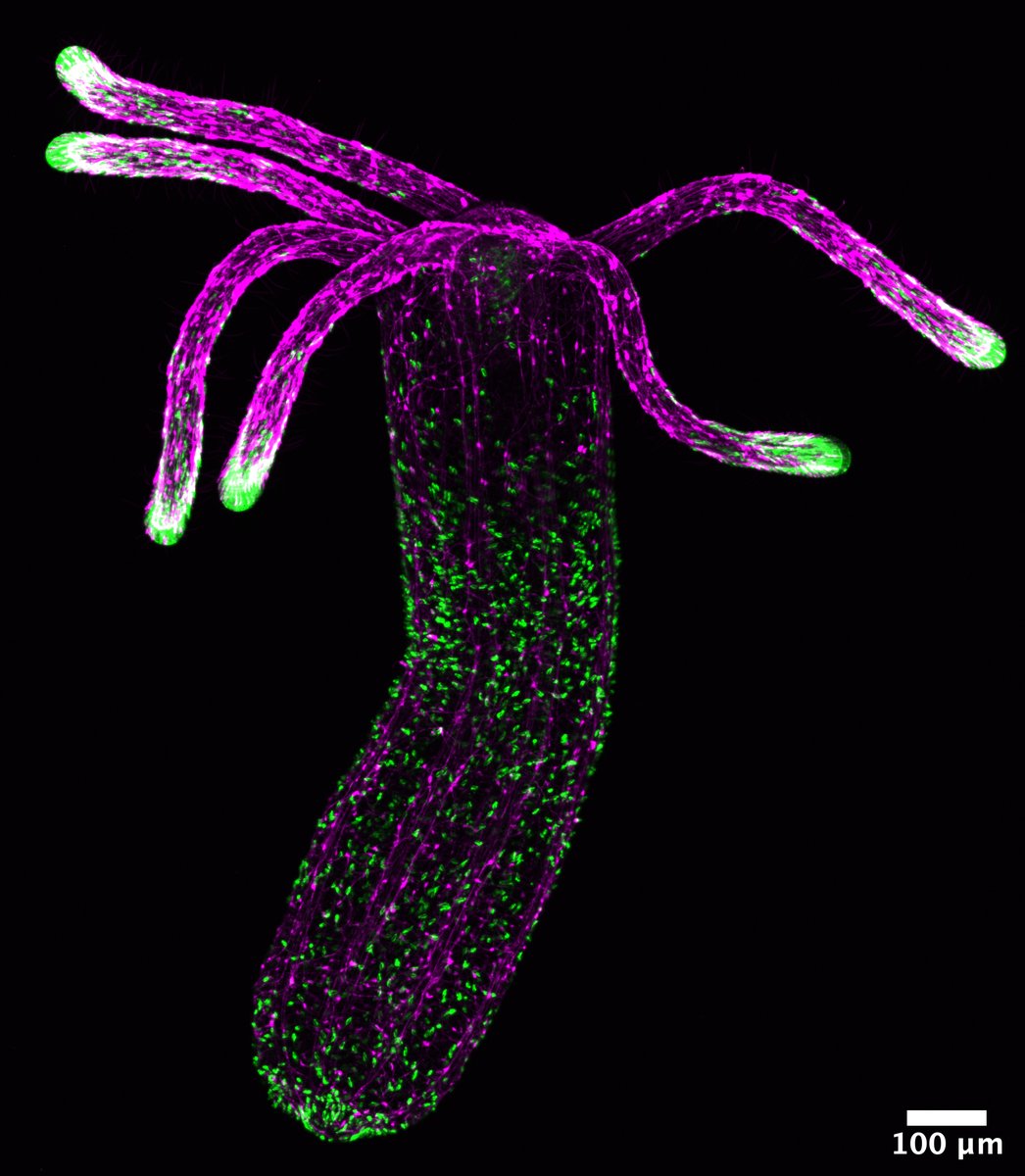 Rachel Scanza (@rachelscanza) on Twitter photo Check out my story for the neat sea anemone stinger science for <a href="/ScienceStowers/">Stowers Institute</a>: stowers.org/news/stinging-… Check out my story for the neat sea anemone stinger science for <a href="/ScienceStowers/">Stowers Institute</a>: stowers.org/news/stinging-…