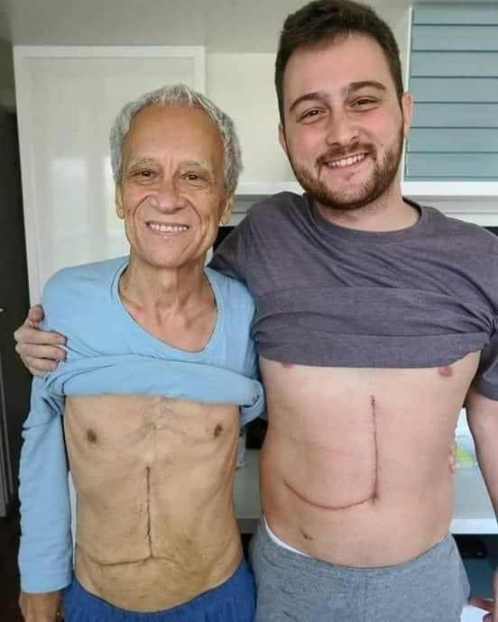 ideanrojass's tweet photo. Maravilloso gesto de amor y de anegación de este hijo que dona el 65% de su hígado para salvar la vida de su padre. que el señor les bendiga.  🥹💙🙏💪 https://t.co/3NEcXaHRbE