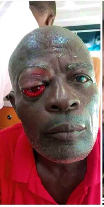 Teflez's tweet image. Bernard Mona and Sammy Gyemfi are were well protected n they are goinna hv sound sleep with their families tonight, but u are going to sleep in the hospital in pain.
Think about it!!!!! This politicians will use you to woefully achieve their political gain
Dampare erhh