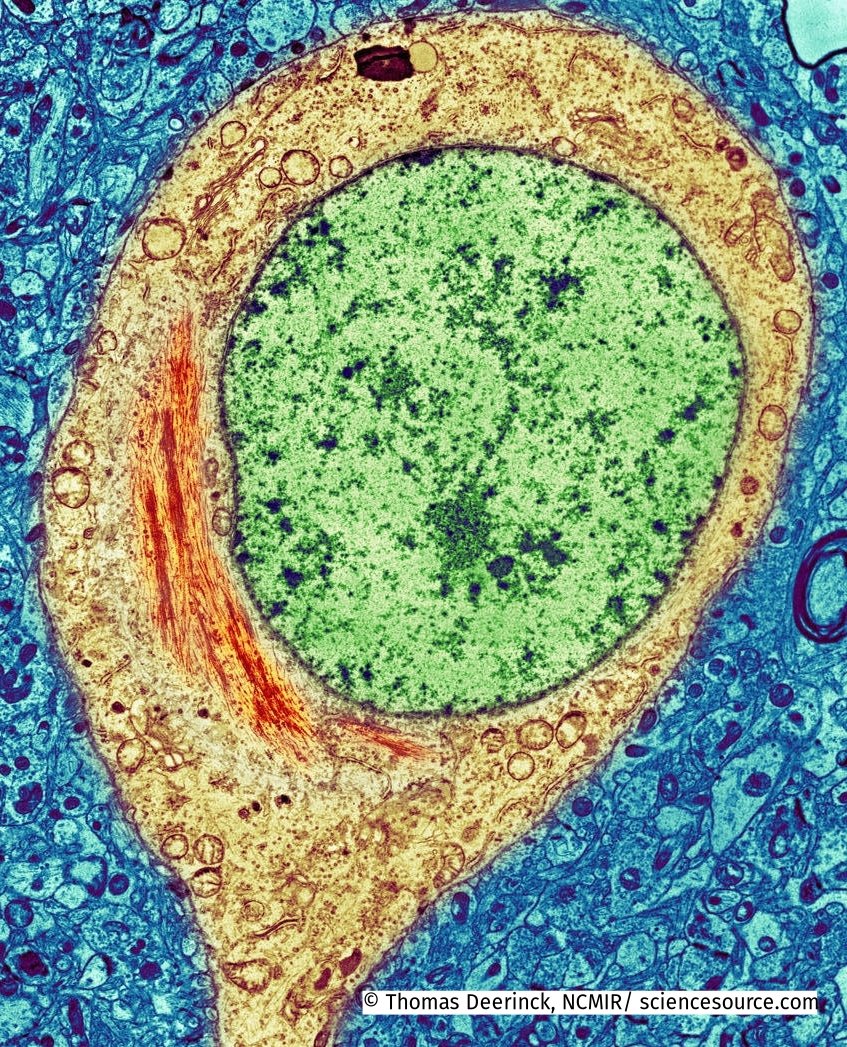 ScienceSource's tweet image. Alzheimer's Disease Brain Cell, TEM
Credit: © Thomas Deerinck, NCMIR / Science Source
ScienceSource.com image ID: SS2260185
#alzheimers #tauprotein #neurofibrillarytangles