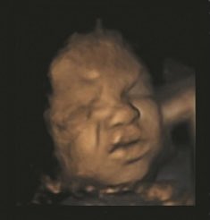EndLessVoIceZ's tweet photo. Roe vs Wade was overturned (killings of unborn babies) by the US Supreme Court. Some people are angry is bc they want to have the option to kill the growing baby if deemed necessary from growing in their bodies. No comment further. #Abortion #Texas #WhoseBody #Ev #EndlessVoicez https://t.co/v1merxsyQP