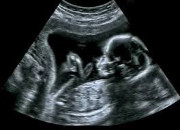 EndLessVoIceZ's tweet photo. Roe vs Wade was overturned (killings of unborn babies) by the US Supreme Court. Some people are angry is bc they want to have the option to kill the growing baby if deemed necessary from growing in their bodies. No comment further. #Abortion #Texas #WhoseBody #Ev #EndlessVoicez https://t.co/v1merxsyQP