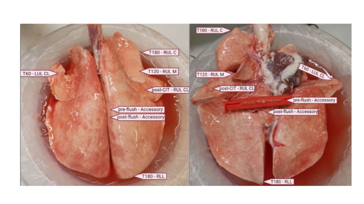 Establishing an #Economical and widely accessible #DCD animal #Abattoir model for #LungResearch using #ExVivo #LungPerfusion
#OnlineFirst👉bit.ly/3Ac2QdW
@Univgroningen🇳🇱| @AUHdk🇩🇰| @MoeslundNiels @ClevelandClinic