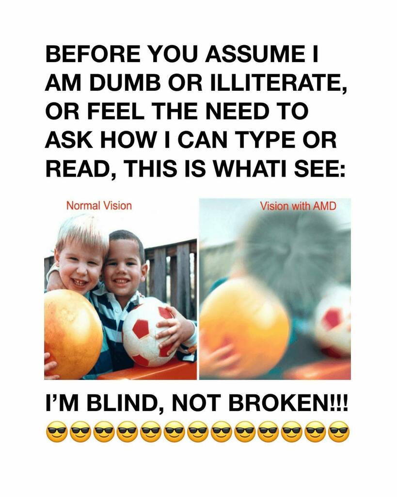 Actually been fielding a lot of questions and assumptions about this. So I thought I’d just make a simple statement. Not meant to be mean or jerky. Just to clarify.#Blind #blind photographer #Macular degeneration #RetinalDystrophy #LowVision instagr.am/p/CfX7XtbO4ch/