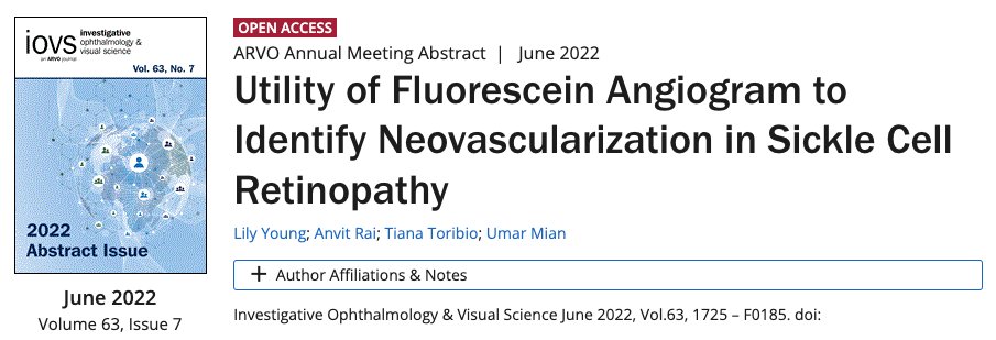 LilyYoungC's tweet photo. Excited to share my research on the use of fluorescein angiography to diagnose neovascularization in sickle cell retinopathy. More to come soon! #ARVO2022 #Ophthotwitter @ARVOinfo @MontefioreNYC 
https://t.co/KQPrjkNWeO https://t.co/Yzf3M9N4wp