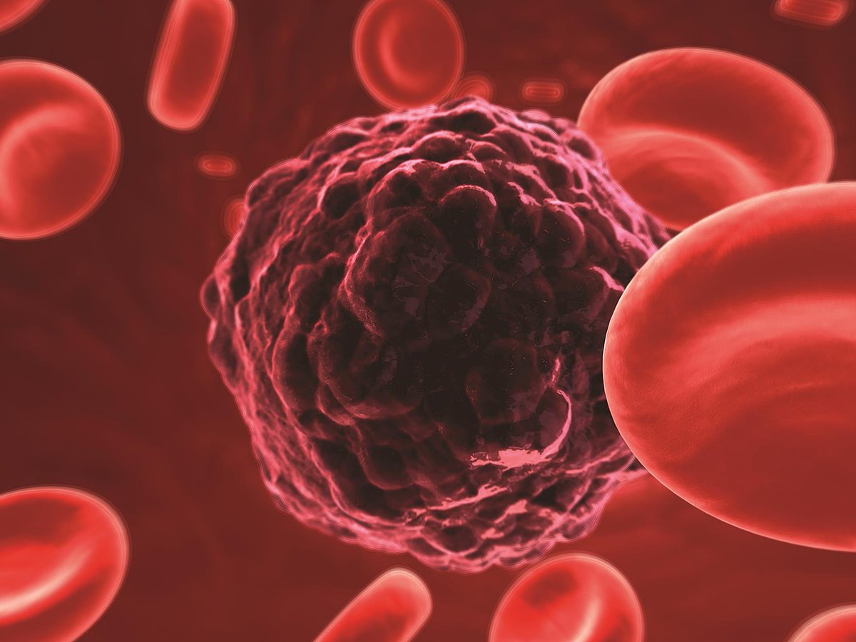 wattjames149's tweet photo. Give your valuable presence as a Speaker at Oncology Congress 2022 is slated on July 27-28, 2022 | Webinar.
For more details: https://t.co/BzRPHa09ag
#cancer #radiology #clinicaloncology #cancertherapy #oncologycongress #celltherapy #cancerbiology https://t.co/gge10v2IwE