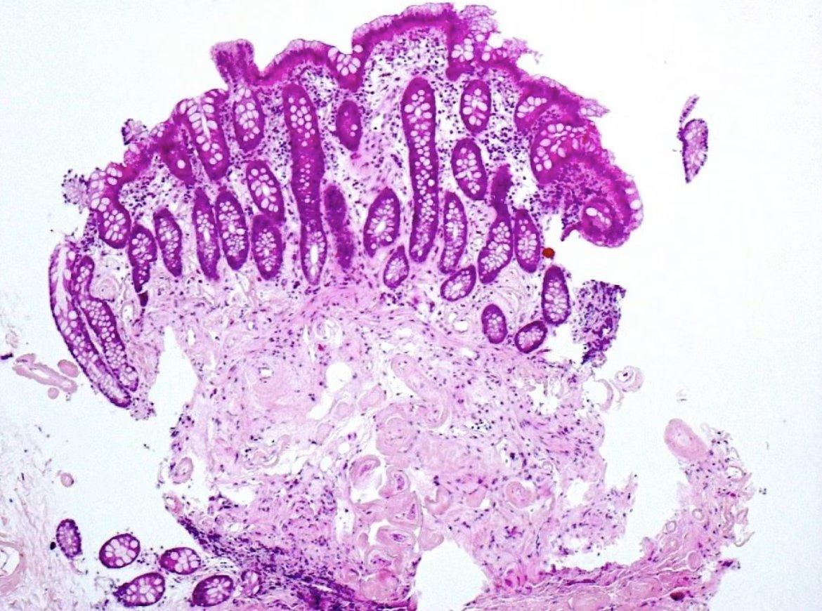 EndoCollab™ | GI Endoscopy Community tweet media