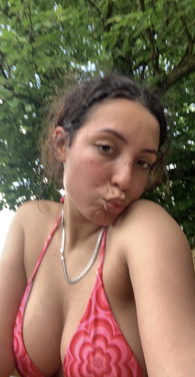 lucyxslut's tweet photo. burnt. https://t.co/4h9tRa6p7i