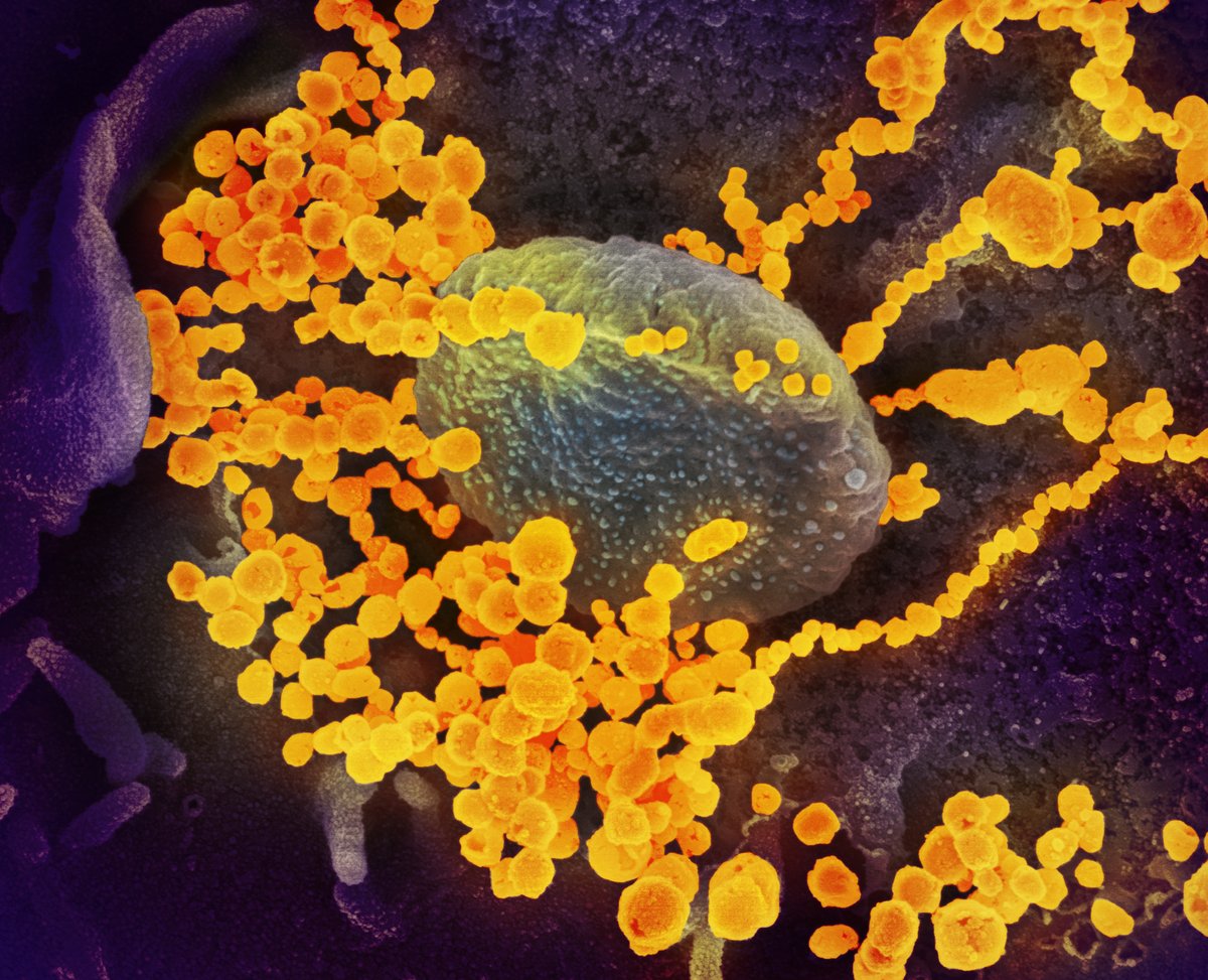 COVID-19 News: A pan-coronavirus vaccine shows protection against #SARSCoV2 and other respiratory coronaviruses in mice and monkeys, NIAID scientists and colleagues show. science.org/doi/10.1126/sc…