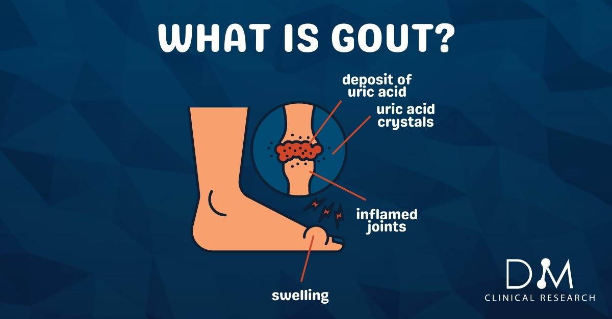 Gout can be very painful and show sudden flares. Learn more about gout studies here: dmclinicalresearch.com/gout/

#gout #uricacid #inflammation #arthritis