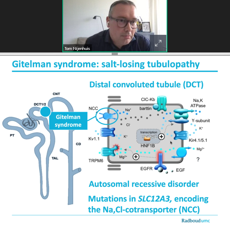 LilianCVillalba's tweet image. #Gitelmansyndrome 
🧐Clínica