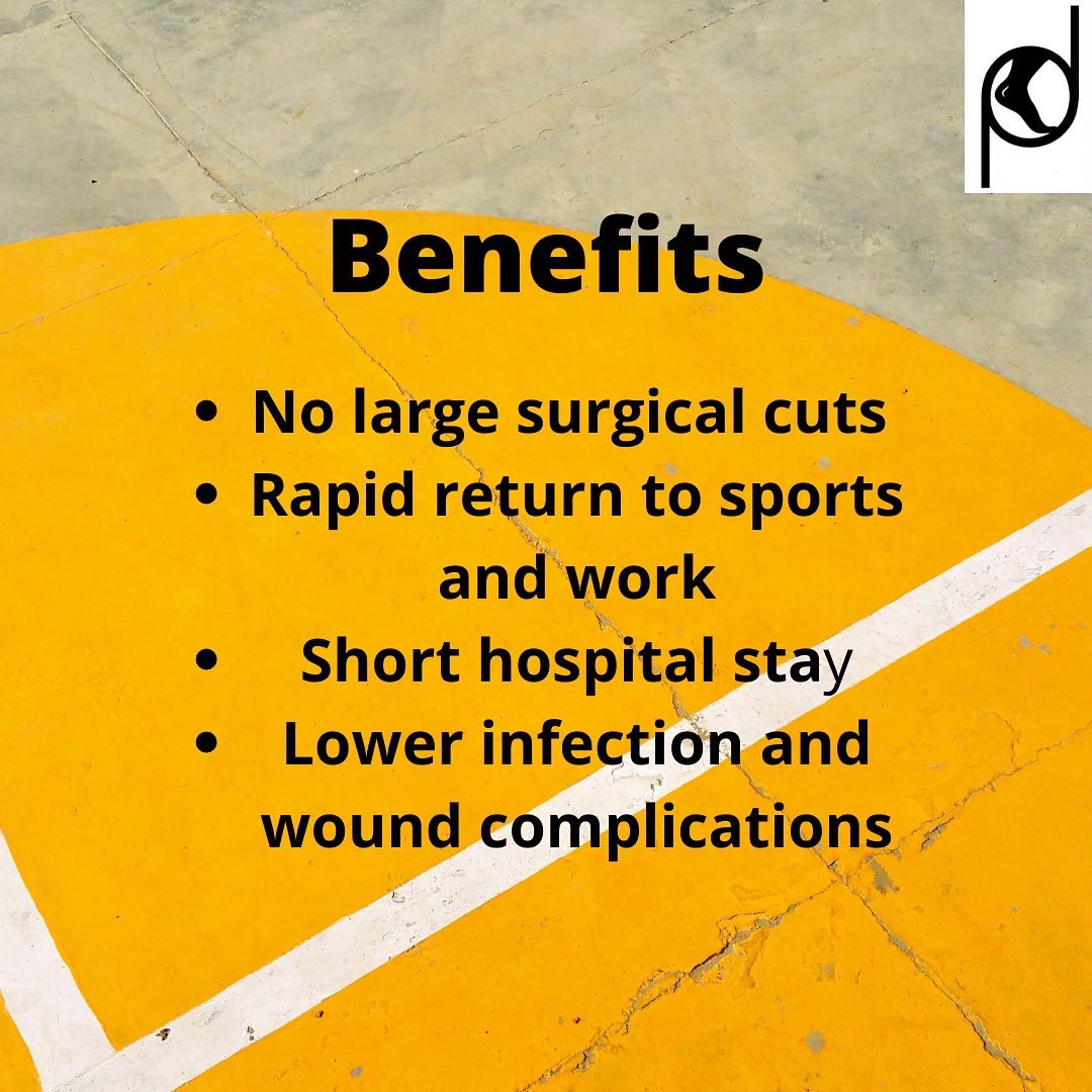 drdeniese's tweet image. #anklearthoscopy is a minimally invasive solution for a plethora of ankle conditions ,recovery rates are quicker and the trauma of surgery is lesser ! #footandanklesurgery #ankleinstability #ankleocd #anklearthritis #anklepain #anklerehab @arthrexmeded @hfhbandra @sportsmedmumbai