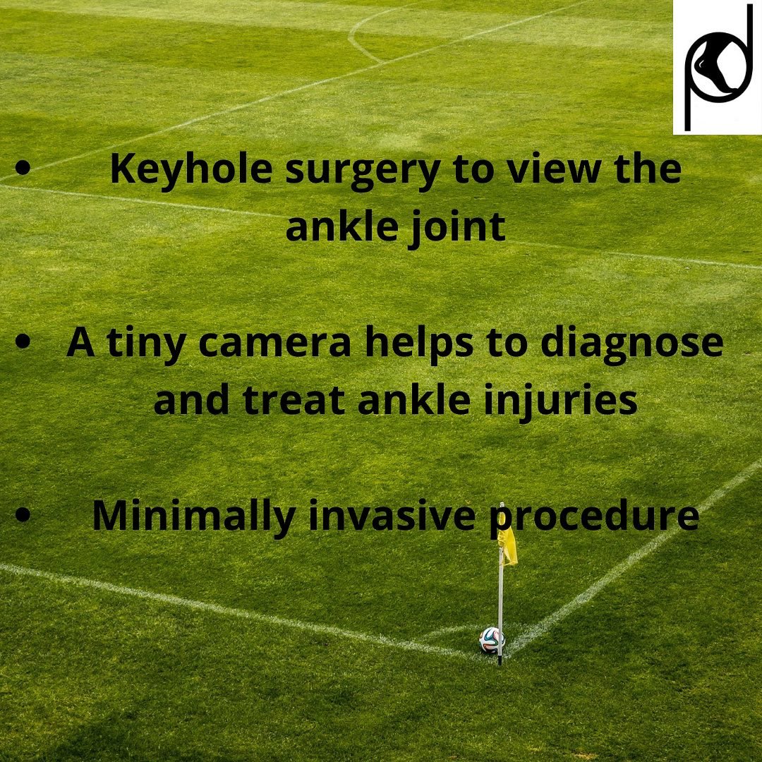 drdeniese's tweet image. #anklearthoscopy is a minimally invasive solution for a plethora of ankle conditions ,recovery rates are quicker and the trauma of surgery is lesser ! #footandanklesurgery #ankleinstability #ankleocd #anklearthritis #anklepain #anklerehab @arthrexmeded @hfhbandra @sportsmedmumbai