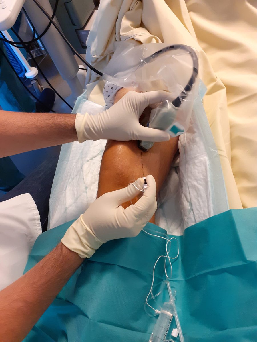 OuahidRahil's tweet photo. #genicularblock
#kneepain
Genicular nerve block for chronic gonalgia https://t.co/4t4eZq9b0c