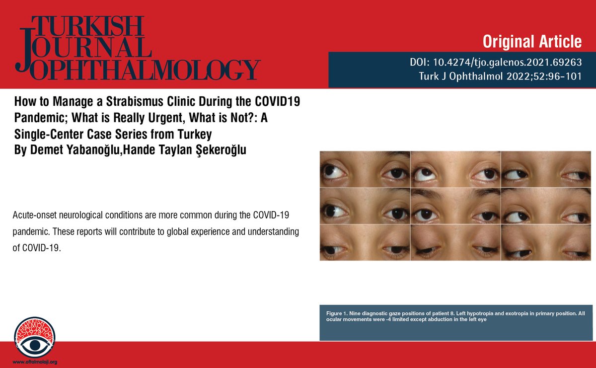 TurkJOphthalmol's tweet image. How to Manage a Strabismus Clinic During the COVID19 Pandemic; What is Really Urgent, What is Not?: A Single-Center Case Series from Turkey

You can see the free full text of the research by Demet Yabanoğlu et al.

Link : cms.oftalmoloji.org/Uploads/Articl…

#COVID19 #acuteonset #strabismus