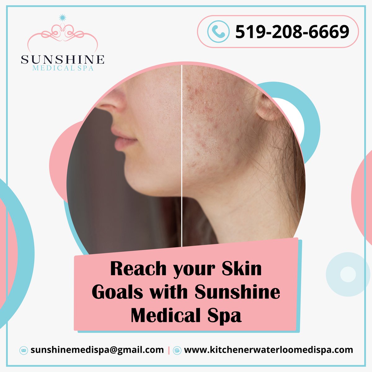 SunshineMediSpa's tweet photo. Did you know you can get rid of annoying fat lumps and excess cellulite? we can help you decrease the unsightly appearance of cellulite and achieve tighter, firmer, and smoother skin. If you also wish to look attractive, book a consultation appointment now at Sunshine Cosmetic. https://t.co/Z8Uhv7tFtl