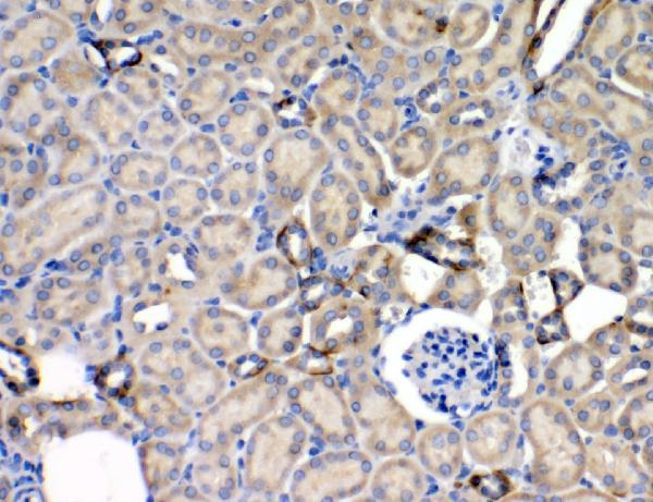 Check out the latest Leptin antibodies from 
<a href="/BosterbioCo/">Boster Bio</a>

#antibodies #polyclonal #monoclonal 
#research #leptin #Science #ScientificResearch 

Click here
antibodyresource.com/site/show/comp…