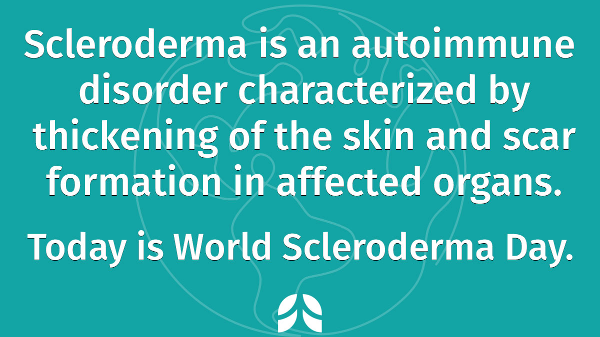 atscommunity's tweet image. Interstitial lung disease is associated with scleroderma, and is a frequent source of symptoms in patients.
On this day in 1940, Swiss painter Paul Klee died. He had scleroderma and his artwork was widely influenced by his experience with the condition. #WorldSclerodermaDay