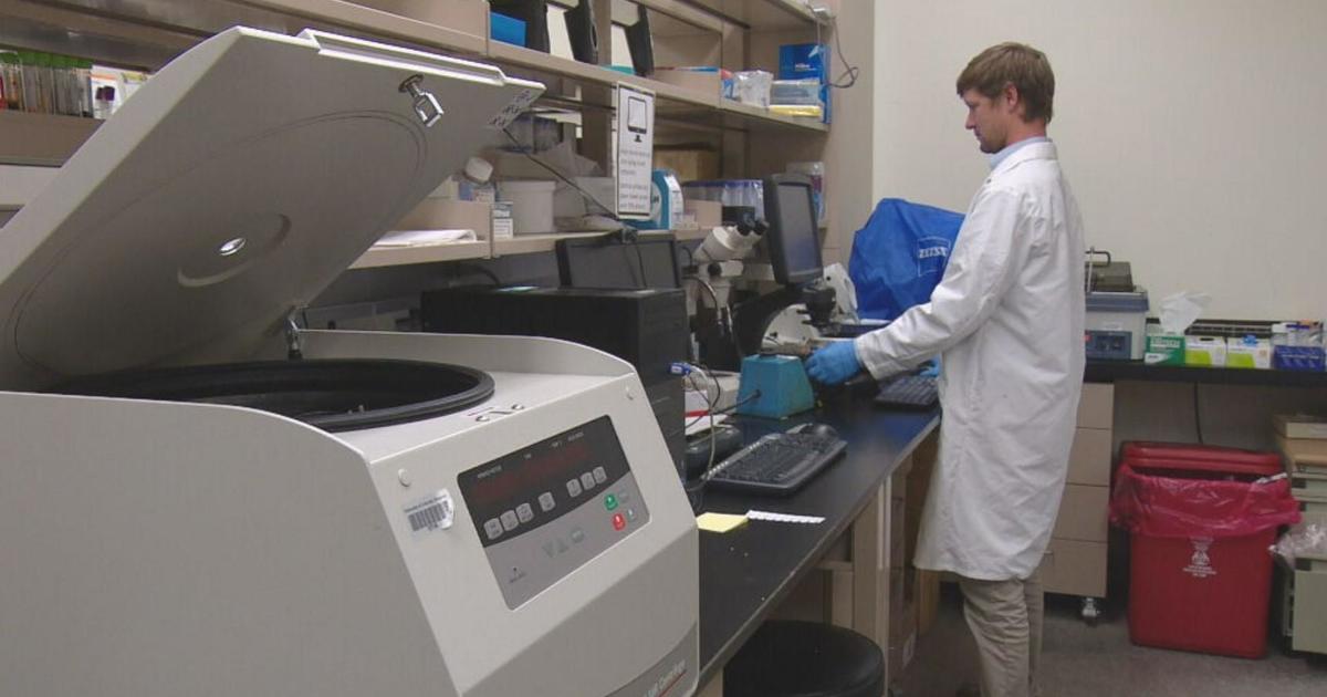 CU Anschutz researchers identify drugs that curb Alzheimer's symptoms cbsnews.com/colorado/news/…