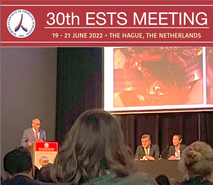 Dr. Burt proudly represented the Baylor College of Medicine Robotic Thoracic Surgery Program at the European STS conference in the Netherlands. @thoracic @BCM_Surgery