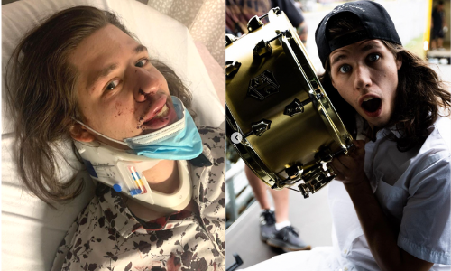 A band from #Worcester known as <a href="/Young_Other/">Young Other</a> was forced to cancel their upcoming shows after their drummer was brutally attacked in #Boston last week. More details below: (📸: Young Other via Instagram) #DailyVoice 
dailyvoice.com/massachusetts/…