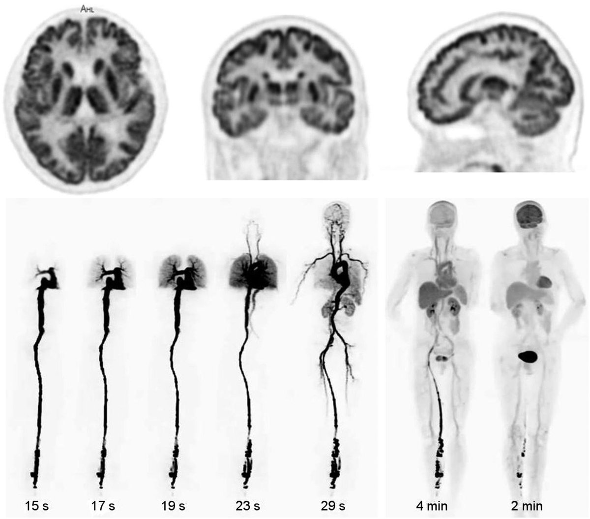 What will the future hold for molecular imaging of neurodegenerative disorders? Read Barthel, Villemagne, and Drzezga’s take: ow.ly/2OhN50JqipM
 
#MedicalImaging #NuclearMedicine #Dementia