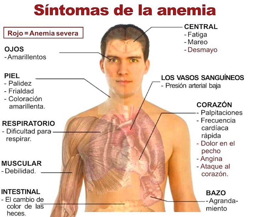 InsuficienciaR's tweet photo. ¿Sabes cuáles son los síntomas de la anemia? Te compartimos algunos de los mas frecuentes. 
Para mas informes llámanos a los teléfonos 55-4320-3971 o 55-4322-8859 
https://t.co/2J152zvDLr https://t.co/cJkKNlHyIp