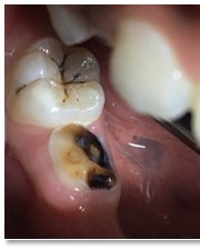 SCFChildren's tweet image. Hard to look at, yet harder to grow up with!  We fight hard every day to break down the barriers to oral health access for children.  #pediatricdentistry #kidsdentist #phillykids #philadelphia #philly #phillynonprofit #COHI #OralHealthMonth