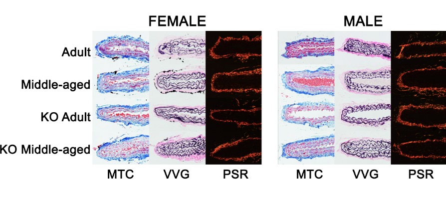ajpheartcirc's tweet photo. #ArticlesInPress: Sex Differences in #Vascular Aging and Impact of #GPER Deletion
(Ogola, et al.)
https://t.co/9v5YxU9lNX
@lab_lindsey @BogolaLab @bruna_vks @Tulane
#SexDifferences #GPER
#VascularAging #ArterialStiffening #PulseWaveVelocity https://t.co/ZLz6VYu11m