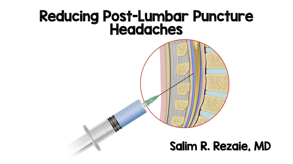 salim-r-rezaie-md-on-twitter-reducing-post-lp-headaches-prevention