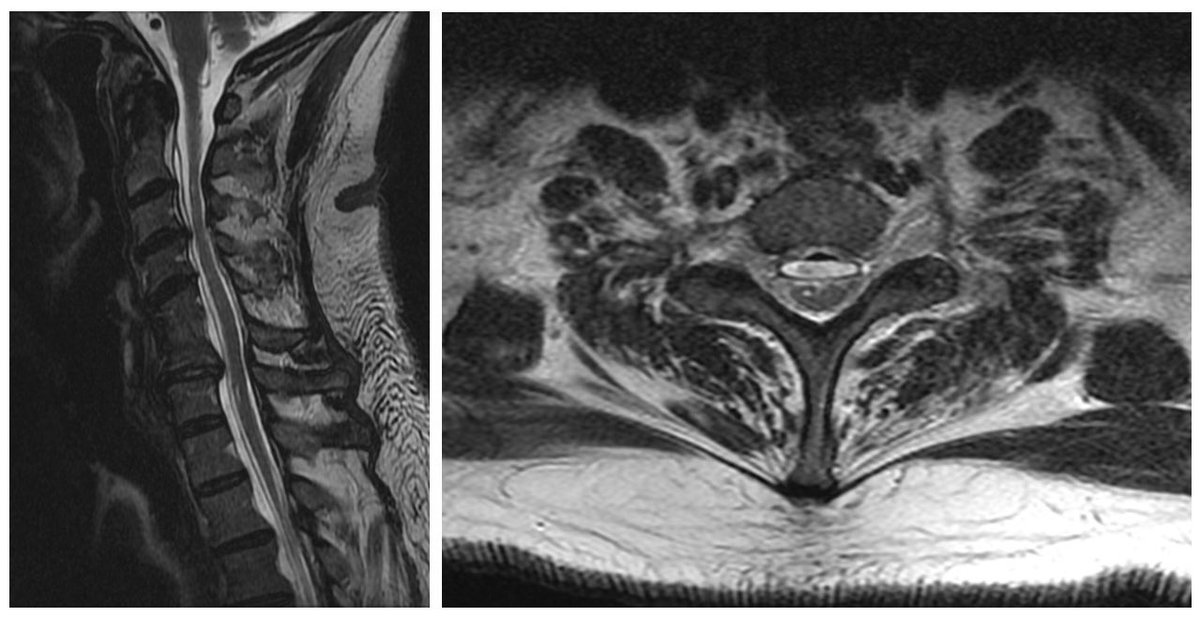 Lyell Jones MD tweet media