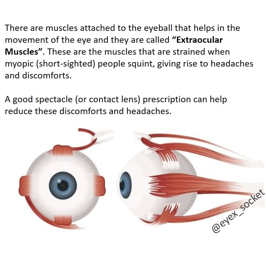 eyex_socket's tweet photo. Squinting and headaches? Why? 🤔🤷🏾‍♂️
#eyexsocket #eyehealth #healthinfo #optometry #vision #sight #facts https://t.co/KfA5Tds2gJ https://t.co/VSL7Or43DQ