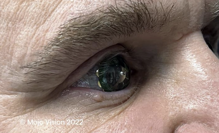 MojoVisionInc's tweet photo. We have completed a successful wear of our fully functional Mojo Lens prototype on eye! Read CEO Drew Perkins' blog post on what it was like to wear a smart contact lens here: https://t.co/VPRyqi06ek
#smartcontactlens #mojolens #invisiblecomputing https://t.co/RClgdyGikt