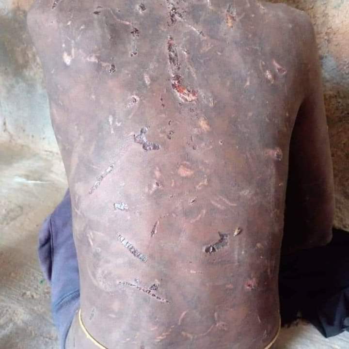 Waa dhacdo argagax ah runtii. 
Sawirkan oo ah gabadh yar oo la noolayd habaryarteed ayaa laga qaaday, kedib markii laga war helay in habaryarta ay la noolayd gabadhani #torture-gareyn jirtay hadiyo goor. Falkani wuxuu ka dhacay magaalada #Laascaanood. <a href="/hrw/">Human Rights Watch</a> <a href="/UNHumanRights/">UN Human Rights</a> <a href="/amnesty/">Amnesty International</a>