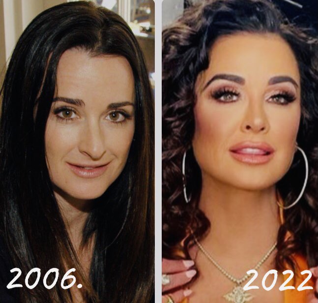 VV™ on X: Kyle Richards. The woman that defines #RHOBHMeanGirls in her  original face. #RHOBH  / X