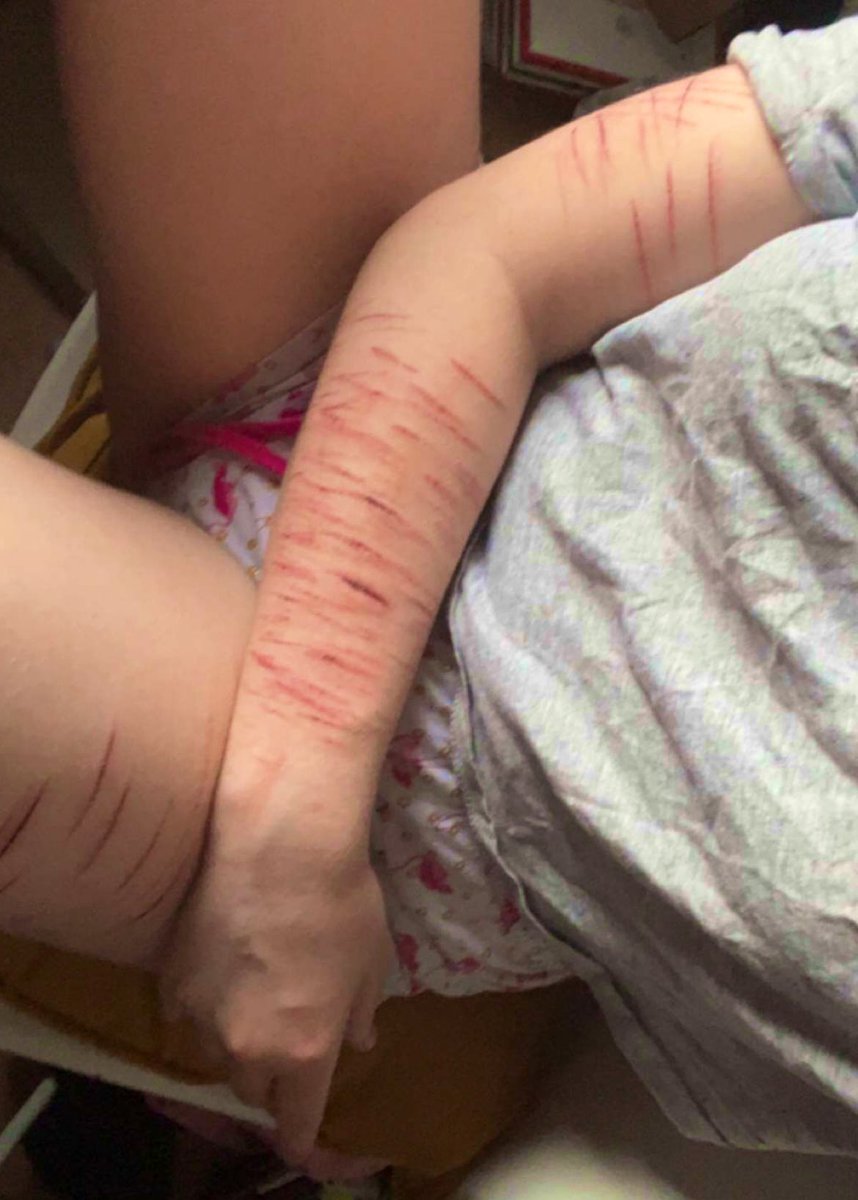 bonecarcus's tweet photo. This is so pretty like the vines in my hands makes me feel so masc 
🏷#shtwt #syrotwt #syrostwt #owchietwt #shtwt #gore #goretwt #babysyros #forbidanjelly #strawberryfillingtwt #sliceandice #bladecore #bloodcore https://t.co/1TWeK5tzlD
