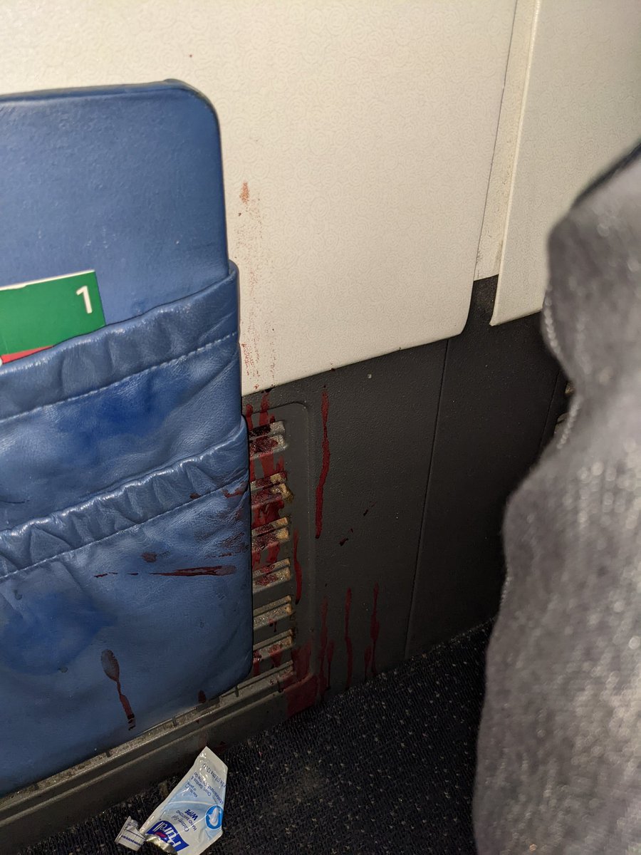 Blood on the seat. Charming that the flight attendant gave me two wipes to clean it up myself. <a href="/Delta/">Delta</a>