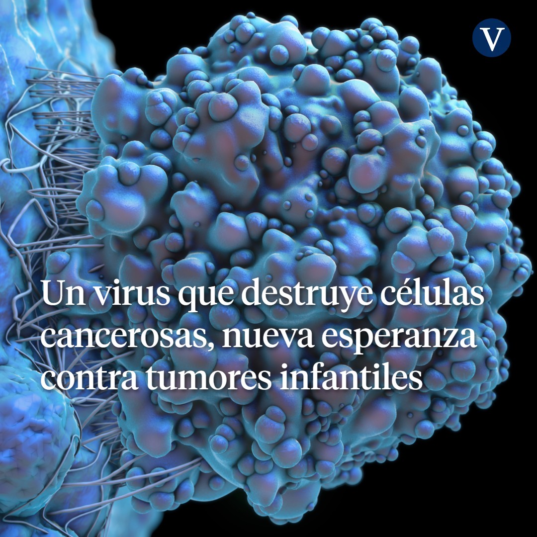 LaVanguardia's tweet photo. 🔴#ÚltimaHora 

Científicos españoles modifican genéticamente un virus del catarro para que destruya células cancerosas contra el tumor cerebral infantil más letal.

El 50% de los niños que lo sufren no sobrevive más de un año. 

✍️Informa @saez_cristina
 
https://t.co/AH55Q1unj6 https://t.co/wYNTbJh8y2