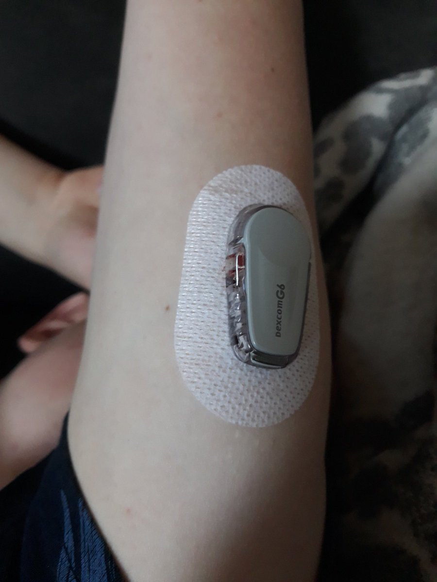 sannismit's tweet photo. Kyborgi
#diabetes
#verensokeri
#sensorointi https://t.co/OmCRZj8WjL
